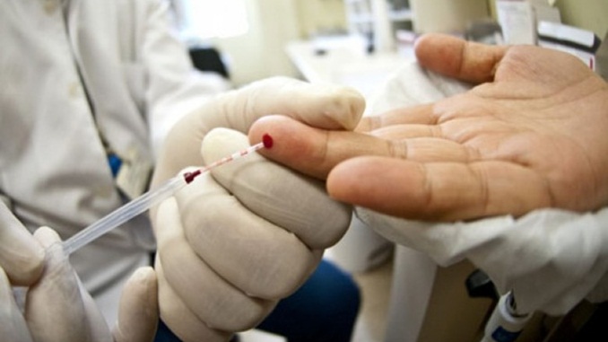 Pelo SUS, a população pode ter acesso a testes rápidos e gratuitos de HIV