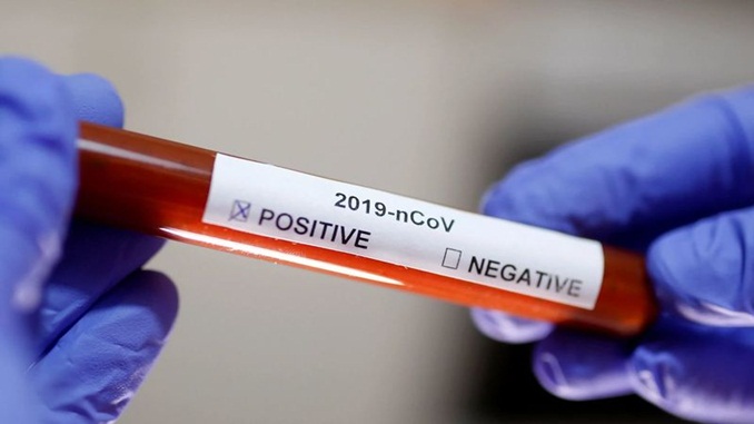 Ministério da Saúde distribui 54 mil testes que identificam o coronavírus