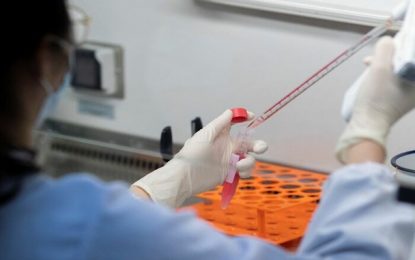 BNDES libera mais de R$ 55 milhões para ampliação dos testes para diagnóstico da Covid-19