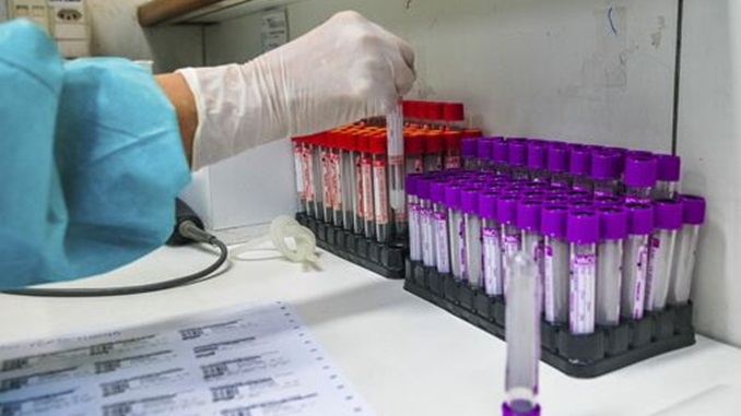 Lei que destina recursos para testes de vacinas nacionais de Covid é sancionada