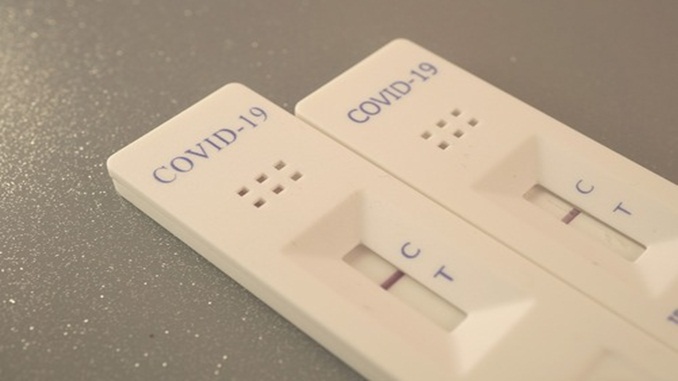 Testes para Covid-19 não servem para medir nível de anticorpos, alerta Anvisa